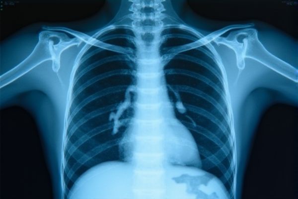 Radiology Technologist Job Opportunities in Pakistan
